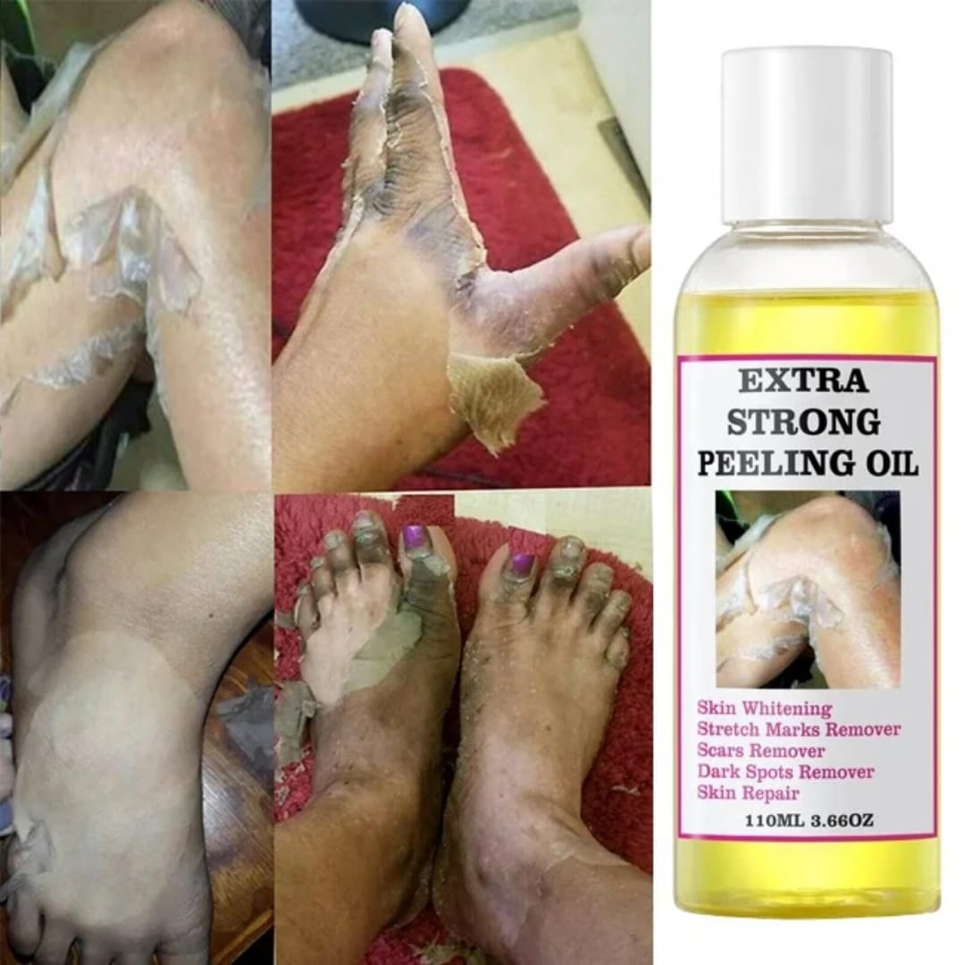 MooYam Extra Strong Peeling Oil thumbnail 5