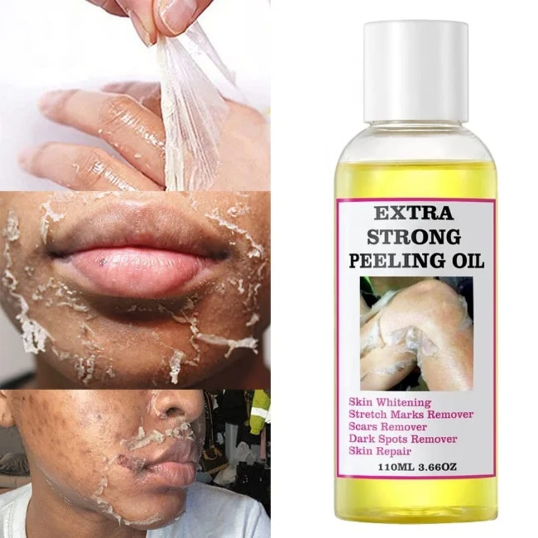 MooYam Extra Strong Peeling Oil thumbnail 3