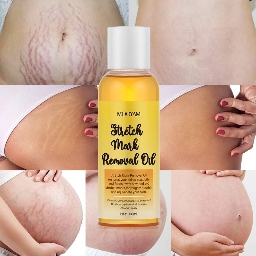 MooYam Stretch Mark Removal Oil thumbnail 2