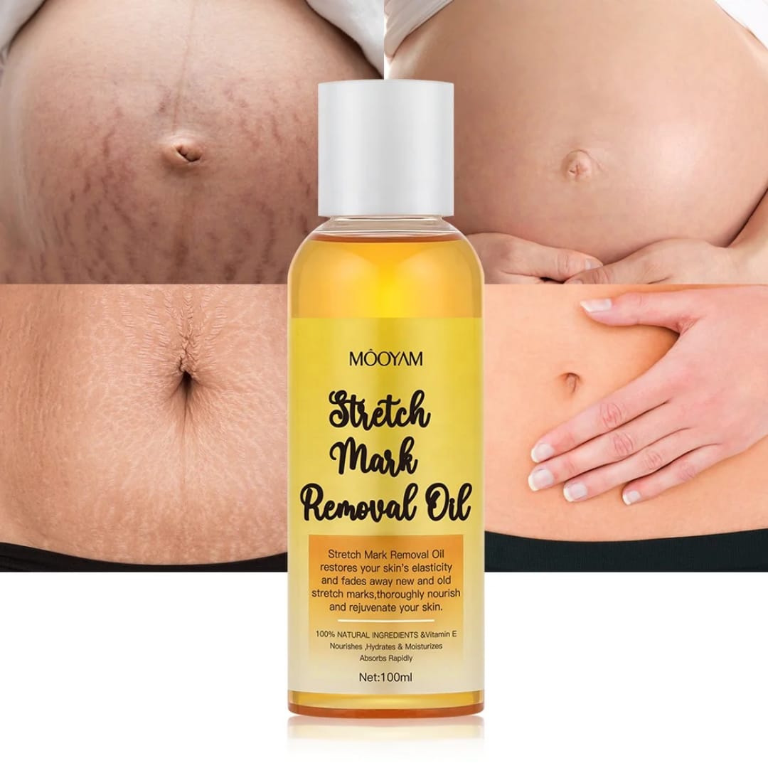 MooYam Stretch Mark Removal Oil